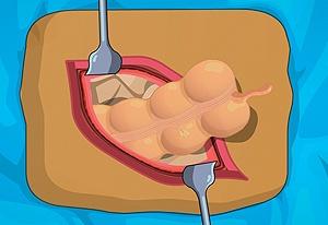 Jogar Operate Now Cirurgia no Estômago no