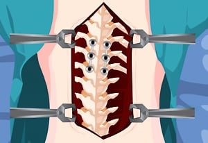 OPERATE NOW: PERICARDIUM SURGERY jogo online gratuito em Minijogos